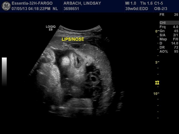 Малыш 39 недель беременности. Снимок УЗИ плода в 39 недель беременности. Положение плода на 39 неделе беременности.