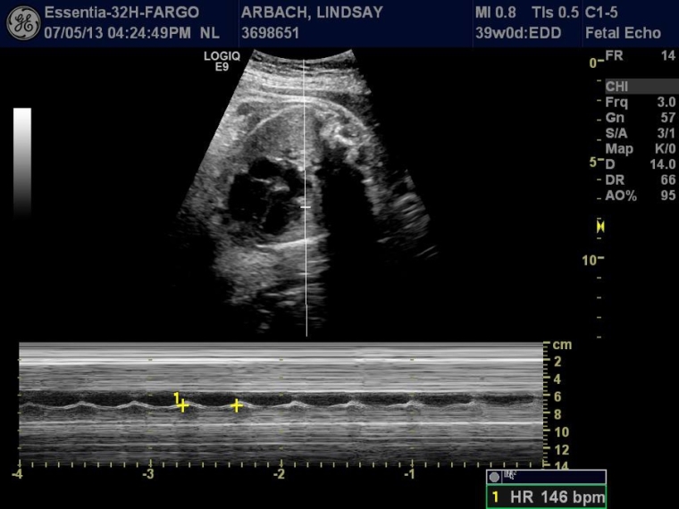 39 Week Ultrasound_0004