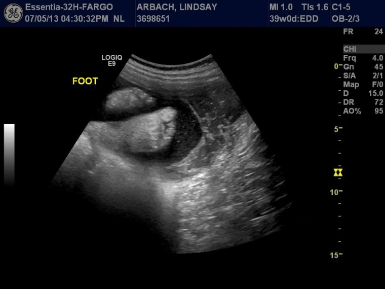39 Week Ultrasound_0005