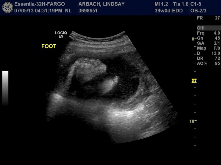 39 Week Ultrasound_0006